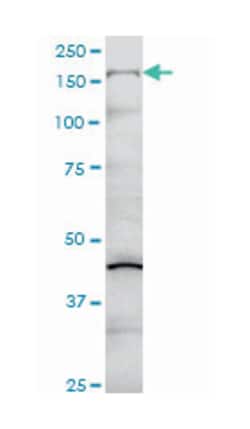 COL5A1, Mouse, Clone: 2F4, Abnova 100&mu;g; Unlabeled:Antibodies, Monoclonal
