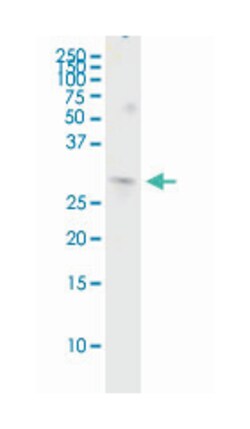 COMT, Rabbit, MaxPab Polyclonal Antibody, Abnova 100&mu;L; Unlabeled:Antibodies,