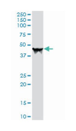 carboxypeptidase A1 (pancreatic), Rabbit, Purified MaxPab Polyclonal Antibody, Abnova 100 &mu;g | Buy Online | Abnova | Fisher Scientific