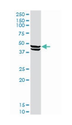 carboxypeptidase A1 (pancreatic), Rabbit, Purified MaxPab Polyclonal Antibody, Abnova 100 &mu;g | Buy Online | Abnova | Fisher Scientific