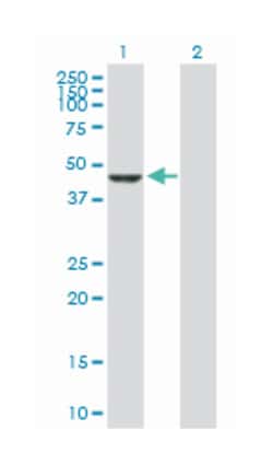carboxypeptidase A2 (pancreatic), Rabbit, Purified MaxPab Polyclonal Antibody, Abnova 100 &mu;g | Buy Online | Abnova | Fisher Scientific