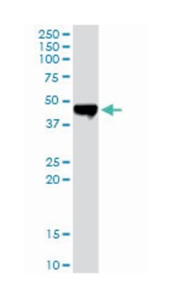 carboxypeptidase A2 (pancreatic), Rabbit, Purified MaxPab Polyclonal Antibody, Abnova 100 &mu;g | Buy Online | Abnova | Fisher Scientific