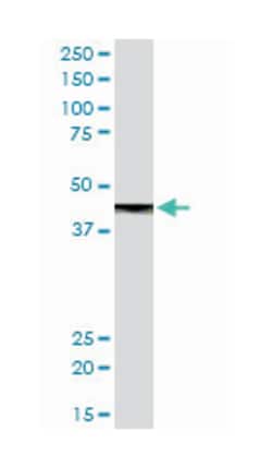 carboxypeptidase B1 (tissue), Rabbit, Purified MaxPab™ Polyclonal Antibody, Abnova™