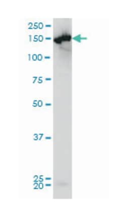 CPS1, Mouse, Clone: 8H8, Abnova 100&mu;g; Unlabeled:Antibodies, Monoclonal