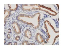 CPS1, Mouse, Clone: 8H8, Abnova 100&mu;g; Unlabeled:Antibodies, Monoclonal