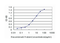 CPS1, Mouse, Clone: 8H8, Abnova&trade;