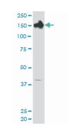 CPS1, Mouse, Clone: 4A10, Abnova 100&mu;g; Unlabeled:Antibodies, Monoclonal