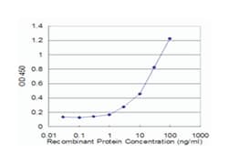 CPT1A, Mouse, Clone: 1D3, Abnova&trade;