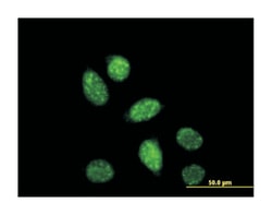 CREB1, Mouse, Clone: 3F1-1B2, Abnova 100&mu;g; Unlabeled:Antibodies, Monoclonal