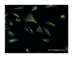 CREBL1, Mouse, Clone: 4D10, Abnova 100&mu;g; Unlabeled:Antibodies, Monoclonal