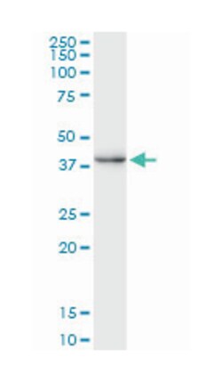 CREM, Mouse, Clone: 3B5, Abnova 100&mu;g; Unlabeled:Antibodies, Monoclonal