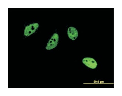 CREM, Mouse, Clone: 3B5, Abnova 100&mu;g; Unlabeled:Antibodies, Monoclonal