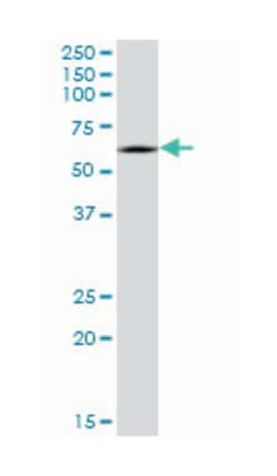 CRMP1, Mouse, Clone: 2B6, Abnova&trade;