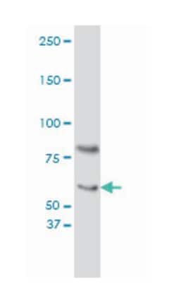 CRY1, Mouse, Clone: 4H4-1C4, Abnova 100&mu;g; Unlabeled:Antibodies, Monoclonal