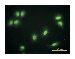 CRY1, Mouse, Clone: 4H4-1C4, Abnova 100&mu;g; Unlabeled:Antibodies, Monoclonal