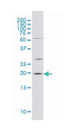 Mouse anti-CRYAB, Clone: S4, Abnova 200&mu;L:Antibodies