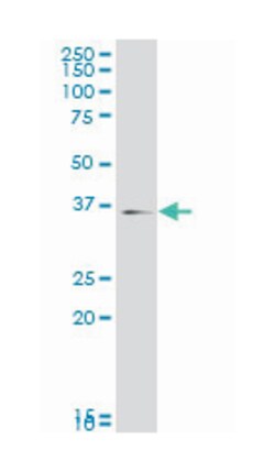 MAPK14, Mouse, Clone: 3D5, Abnova 200&mu;L; Unlabeled:Antibodies, Monoclonal