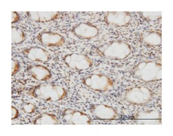 CSE1 chromosome segregation 1-like (yeast), Mouse, Clone: 2C10, Abnova 100 &mu;g | Buy Online | Abnova Corporation | Fisher Scientific
