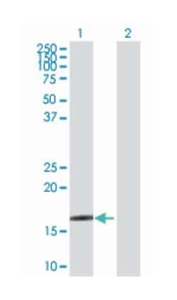 crystallin, gamma D, Rabbit, Purified MaxPab Polyclonal Antibody, Abnova