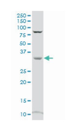 crystallin, zeta (quinone reductase), Mouse, Polyclonal Antibody, Abnova 50 &mu;L | Buy Online | Abnova Corporation | Fisher Scientific