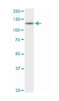 CSF1R, Mouse, Clone: 1G4, Abnova 100&mu;g; Unlabeled:Antibodies, Monoclonal