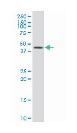 casein kinase 1, delta, Mouse, Polyclonal Antibody, Abnova&trade;