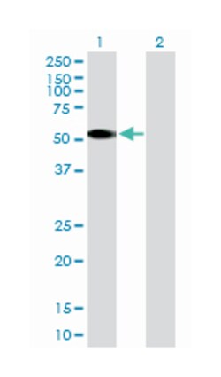 casein kinase 1, gamma 2, Rabbit, Purified MaxPab Polyclonal Antibody, Abnova 100 &mu;g | Buy Online | Abnova | Fisher Scientific