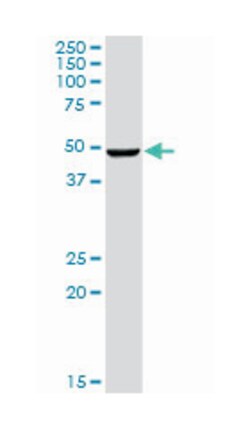 casein kinase 1, gamma 2, Rabbit, Purified MaxPab Polyclonal Antibody, Abnova 100 &mu;g | Buy Online | Abnova | Fisher Scientific