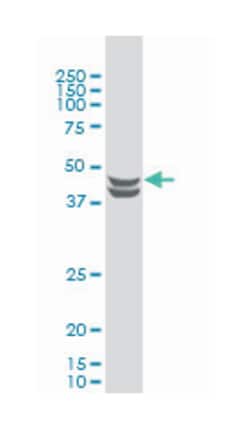 CSNK2A1, Mouse, Clone: 3D9, Abnova 100&mu;g; Unlabeled:Antibodies, Monoclonal
