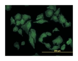 CSNK2A1, Mouse, Clone: 3D9, Abnova 100&mu;g; Unlabeled:Antibodies, Monoclonal