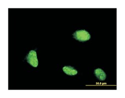 cysteine and glycine-rich protein 1, Mouse, Clone: 2A11, Abnova 100 &mu;g | Buy Online | Abnova Corporation | Fisher Scientific