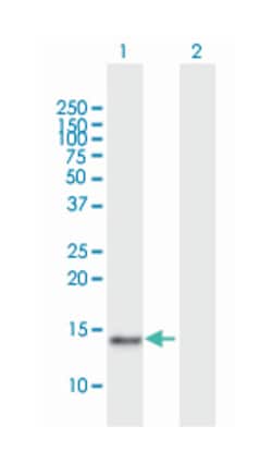 cystatin SN, Mouse, Purified MaxPab Polyclonal Antibody, Abnova 50 &mu;g | Buy Online | Abnova | Fisher Scientific