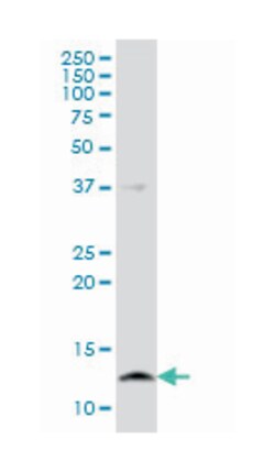 cystatin B (stefin B), Mouse, Clone: M2-F1, Abnova 100&mu;g; Unlabeled:Antibodies,