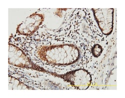 cystatin B (stefin B), Mouse, Clone: M2-F1, Abnova 100&mu;g; Unlabeled:Antibodies,