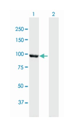 catenin (cadherin-associated protein), alpha 2, Mouse, Polyclonal Antibody, Abnova 50 &mu;L | Buy Online | Abnova | Fisher Scientific