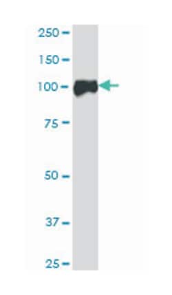 catenin (cadherin-associated protein), alpha 2, Mouse, Polyclonal Antibody, Abnova 50 &mu;L | Buy Online | Abnova | Fisher Scientific