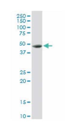 cathepsin D, Rabbit, Purified MaxPab Polyclonal Antibody, Abnova 100&mu;g;