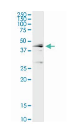 cathepsin D, Rabbit, Purified MaxPab Polyclonal Antibody, Abnova 100&mu;g;