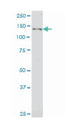 jagged 2, Mouse, Clone: 1C5, Abnova&trade;