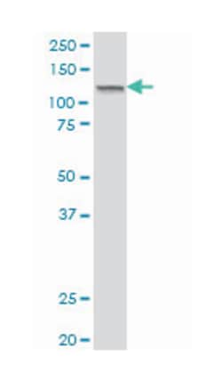 jumonji, AT rich interactive domain 2, Mouse, Polyclonal Antibody, Abnova 50 &mu;L | Buy Online | Abnova | Fisher Scientific