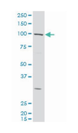 potassium voltage-gated channel, subfamily H (eag-related), member 1, Mouse, Polyclonal Antibody, Abnova 50 &mu;L | Buy Online | Abnova | Fisher Scientific