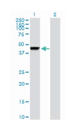 cathepsin D, Rabbit, Purified MaxPab Polyclonal Antibody, Abnova 100&mu;g;