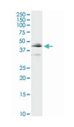cathepsin D, Rabbit, Purified MaxPab Polyclonal Antibody, Abnova 100&mu;g;
