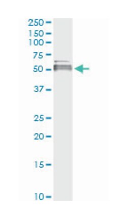 lipase A, lysosomal acid, cholesterol esterase, Mouse, Clone: 1F9, Abnova 100 &mu;g | Buy Online | Abnova Corporation | Fisher Scientific
