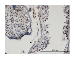 LMX1B, Mouse, Clone: 1D12, Abnova 100&mu;g; Unlabeled:Antibodies, Monoclonal