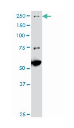 MAP3K4, Mouse, Clone: X1, Abnova 200&mu;L; Unlabeled:Antibodies, Monoclonal