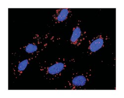 met proto-oncogene (hepatocyte growth factor receptor), Mouse, Purified