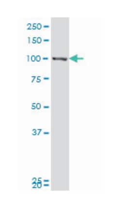 mutS homolog 2, colon cancer, nonpolyposis type 1 (E. coli) (A01), Mouse anti-Human, Polyclonal Antibody, Abnova&trade;