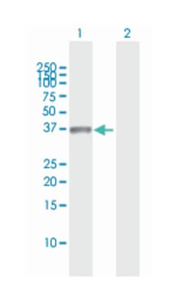 MSX1, Rabbit, MaxPab Polyclonal Antibody, Abnova 100 &mu;L | Buy Online | Abnova Corporation | Fisher Scientific