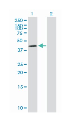 NADH dehydrogenase (ubiquinone) Fe-S protein 2, 49kDa (NADH-coenzyme Q